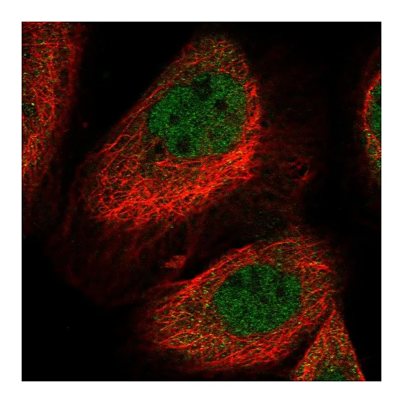 Atlas Antibodies Anti-LYST Antibody