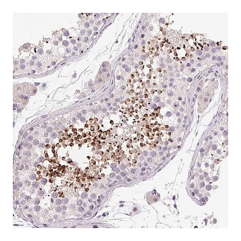 Atlas Antibodies Anti-LYZL6 Antibody