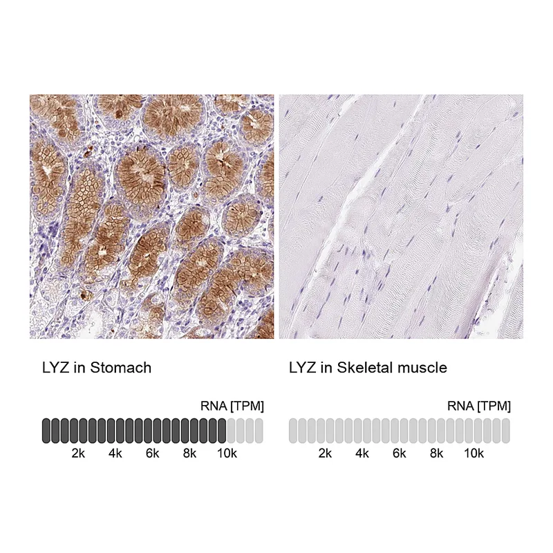 Atlas Antibodies Anti-LYZ Antibody