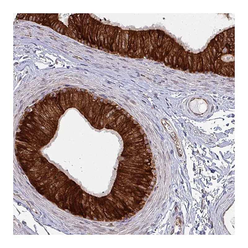 Atlas Antibodies Anti-LYSMD4 Antibody