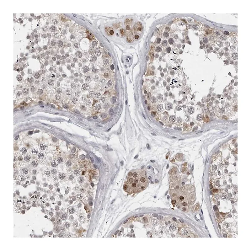 Atlas Antibodies Anti-LZIC Antibody