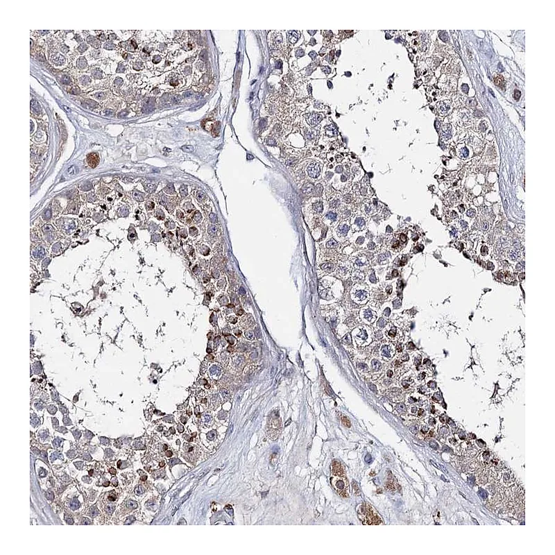 Atlas Antibodies Anti-LYZL4 Antibody
