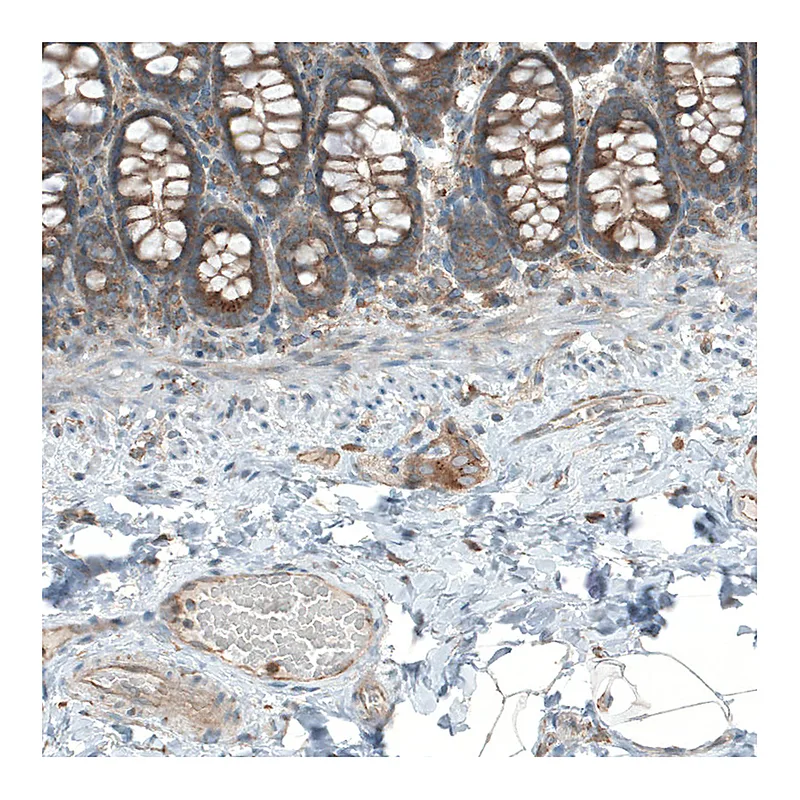 Atlas Antibodies Anti-LZTR1 Antibody