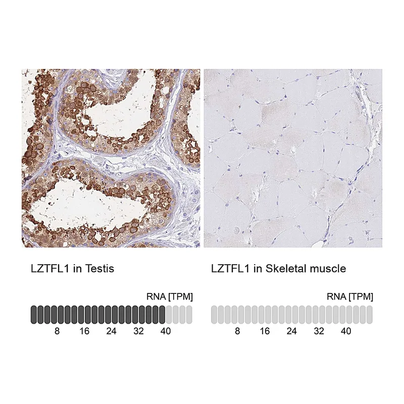 Atlas Antibodies Anti-LZTFL1 Antibody