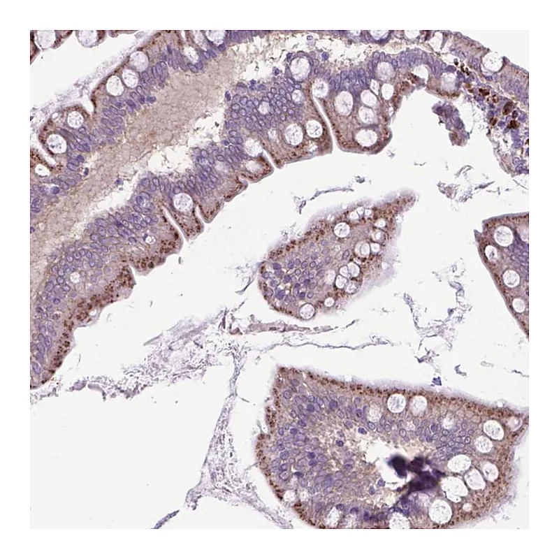 Atlas Antibodies Anti-LZTR1 Antibody