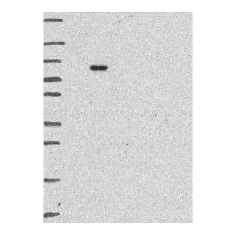 Atlas Antibodies Anti-LZTR1 Antibody