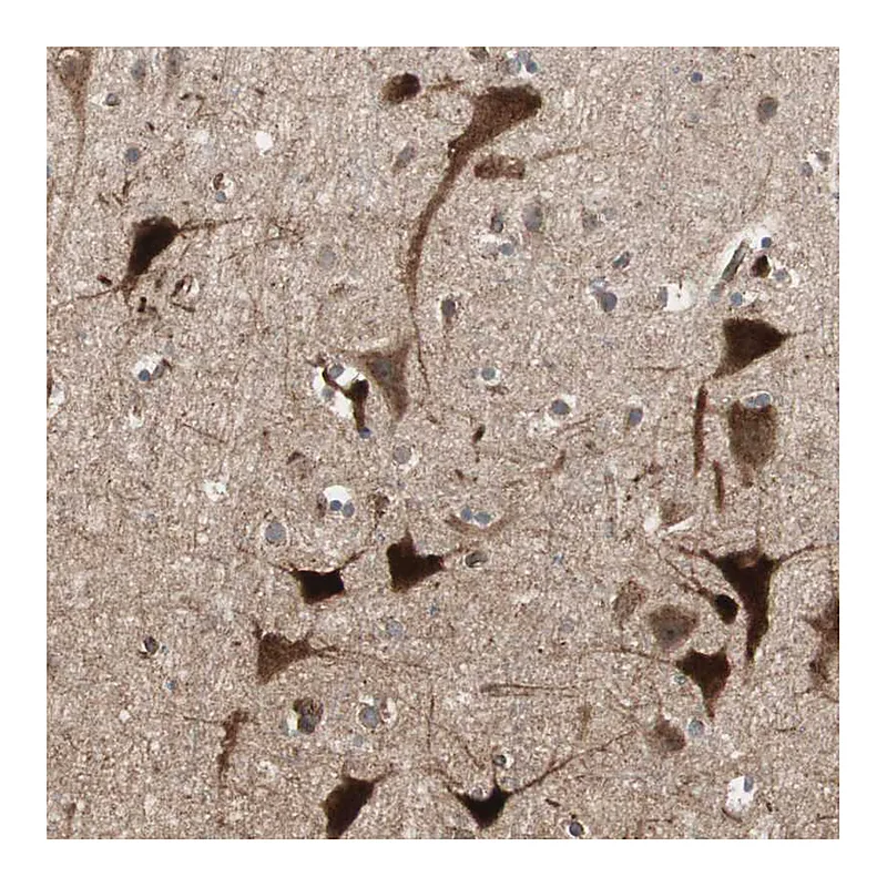Atlas Antibodies Anti-LZTS1 Antibody