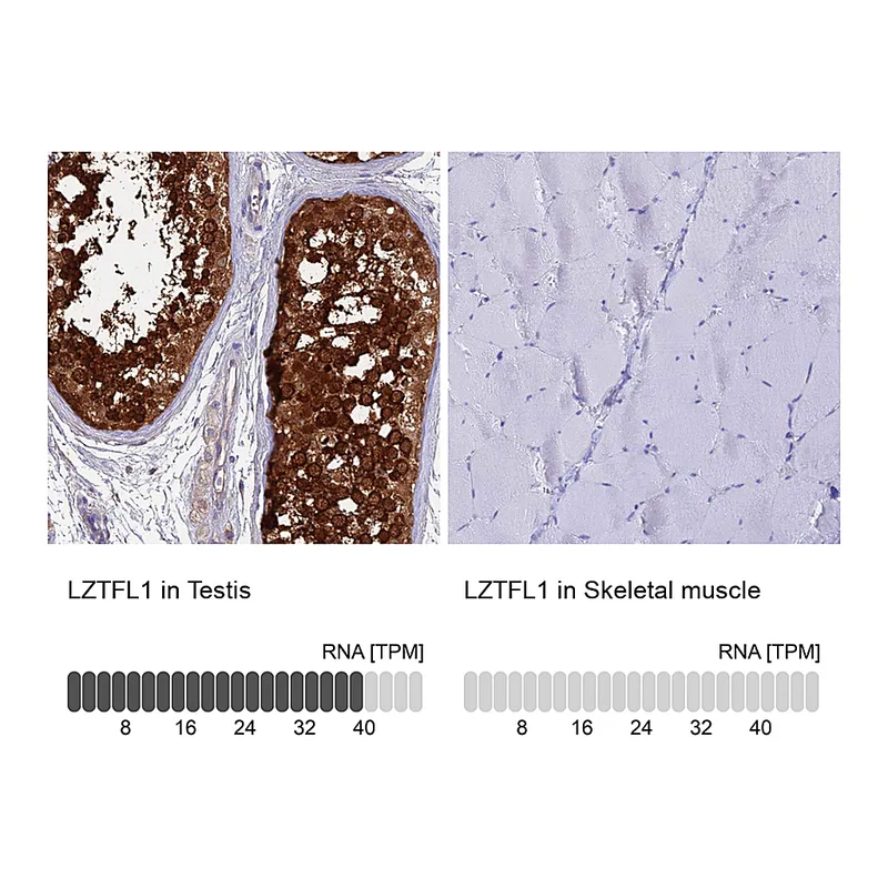 Atlas Antibodies Anti-LZTFL1 Antibody