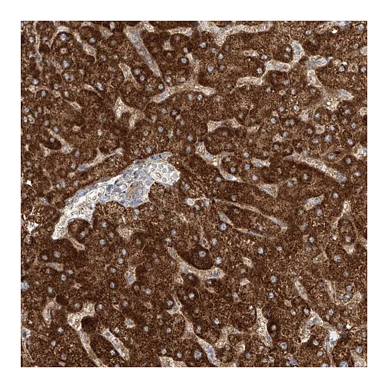 Atlas Antibodies Anti-LZTS3 Antibody