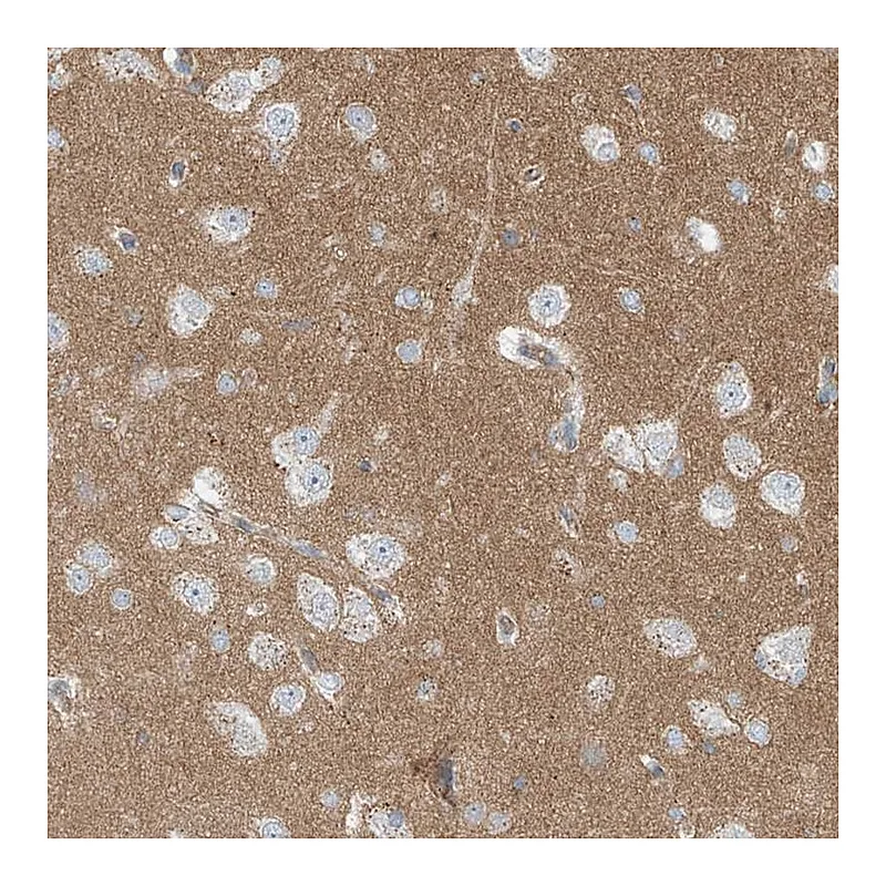 Atlas Antibodies Anti-LZTS3 Antibody