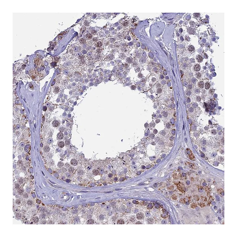 Atlas Antibodies Anti-M1AP Antibody