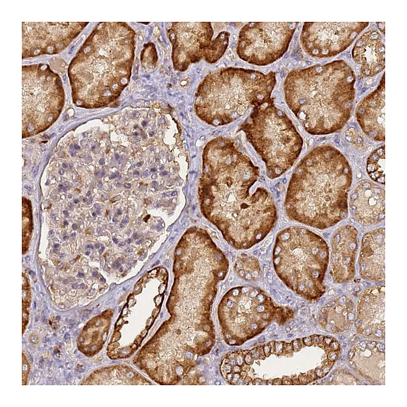 Atlas Antibodies Anti-M6PR Antibody