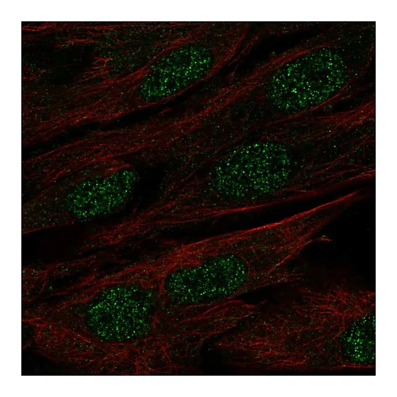 Atlas Antibodies Anti-MAB21L1 Antibody