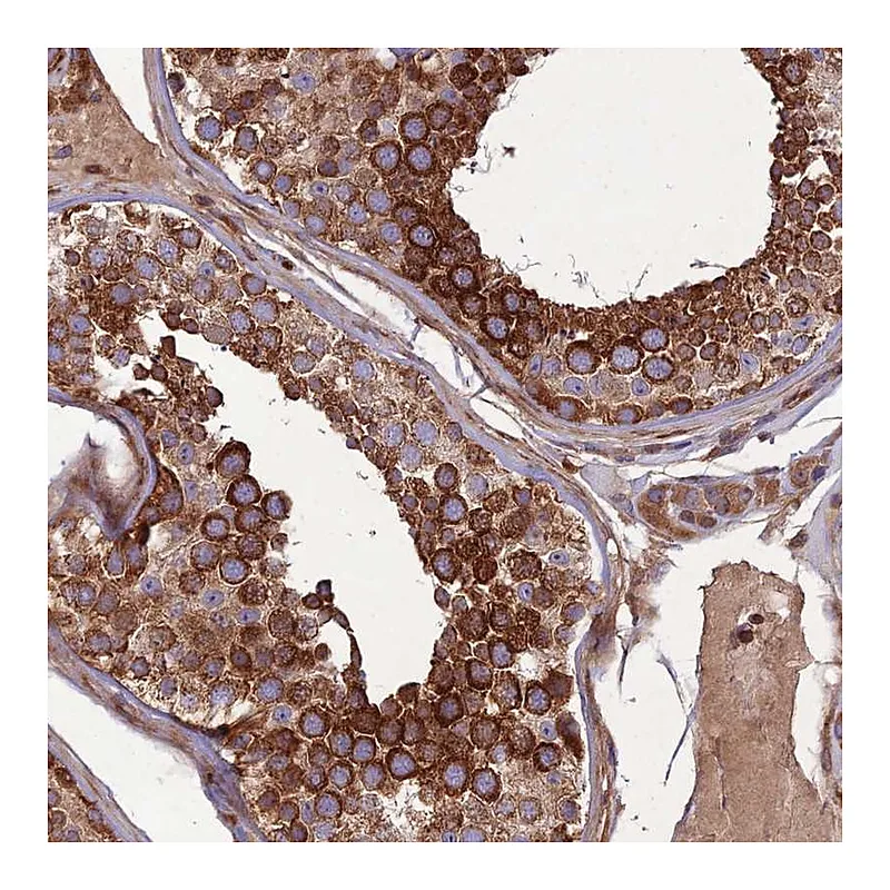 Atlas Antibodies Anti-MAB21L3 Antibody