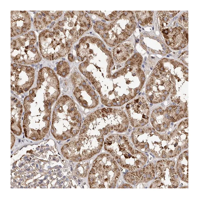 Atlas Antibodies Anti-MACC1 Antibody