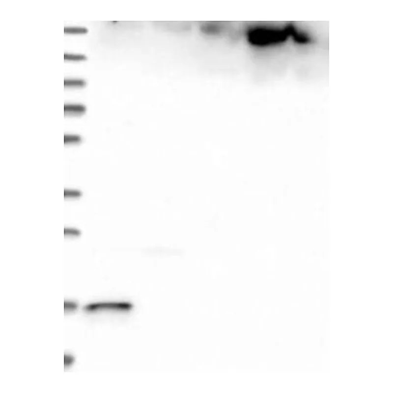 Atlas Antibodies Anti-MAD2L2 Antibody