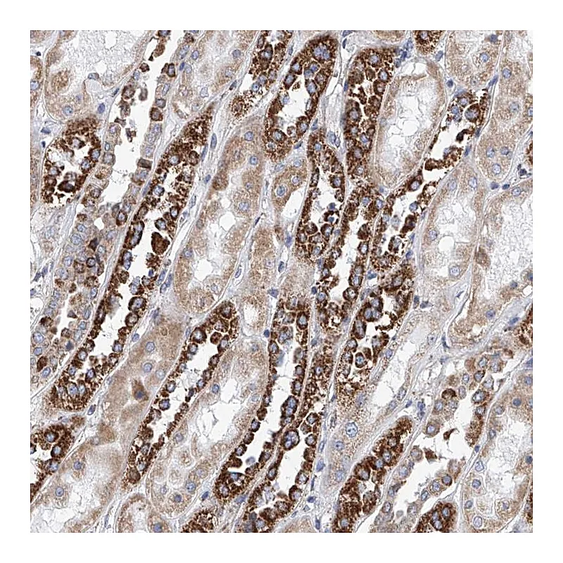 Atlas Antibodies Anti-MAD2L1 Antibody