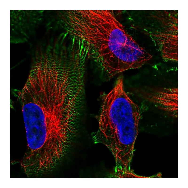 Atlas Antibodies Anti-MACF1 Antibody