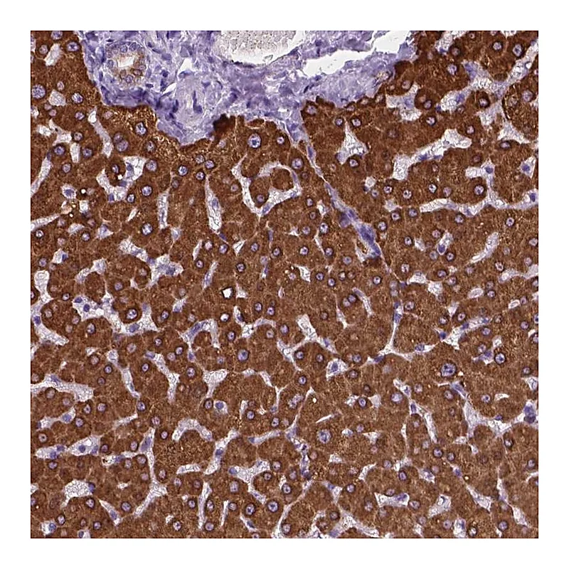 Atlas Antibodies Anti-MACF1 Antibody