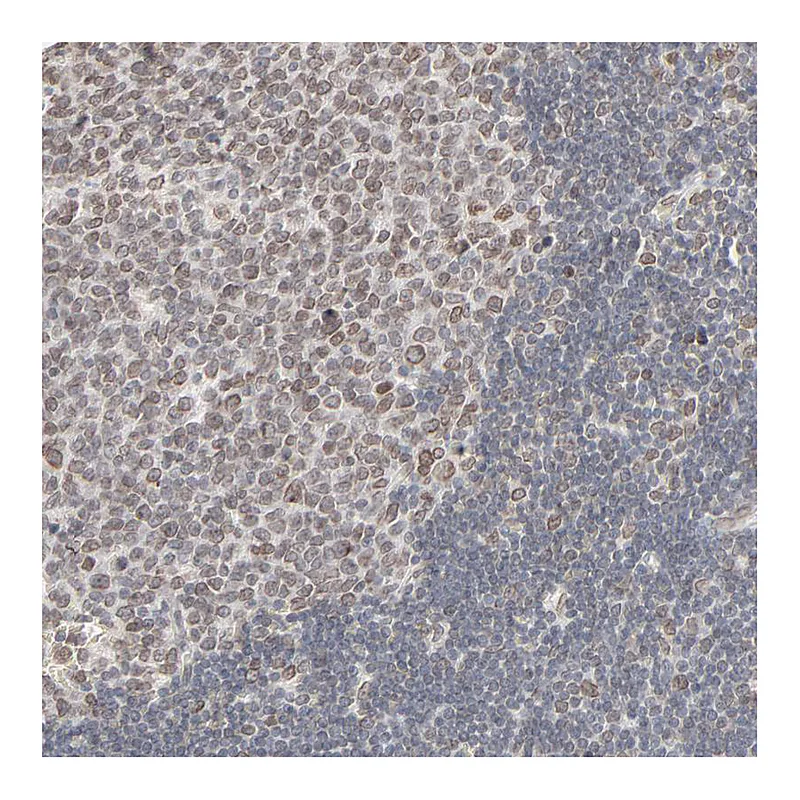 Atlas Antibodies Anti-MAD1L1 Antibody