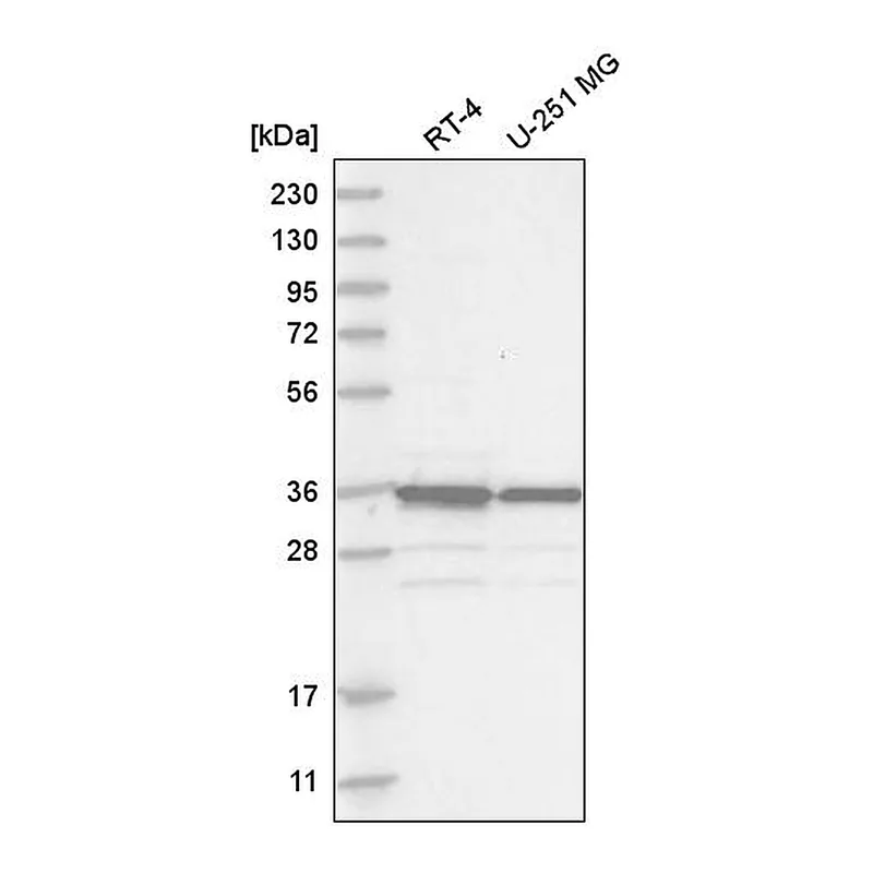 Atlas Antibodies Anti-MAD2L1BP Antibody