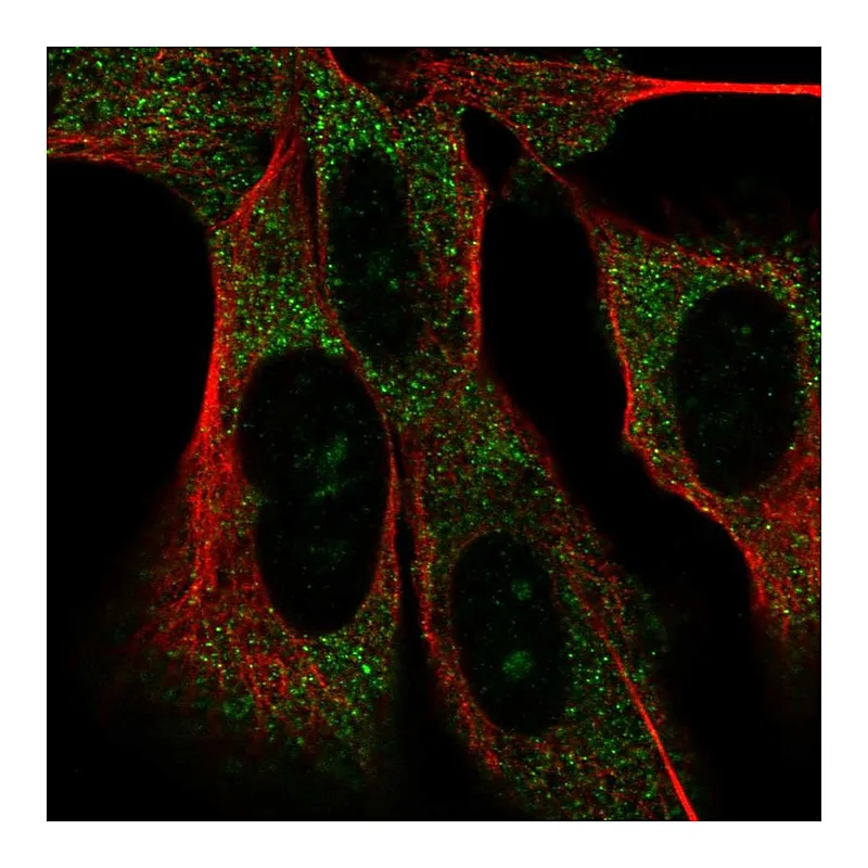 Atlas Antibodies Anti-MAD2L2 Antibody