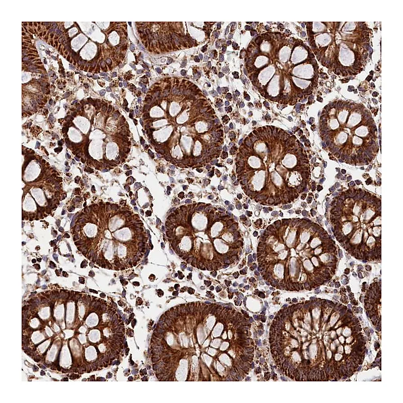 Atlas Antibodies Anti-MACROD1 Antibody