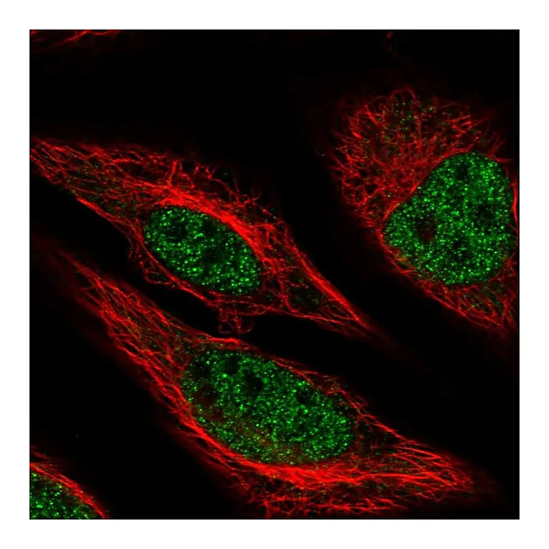 Atlas Antibodies Anti-MACROD1 Antibody