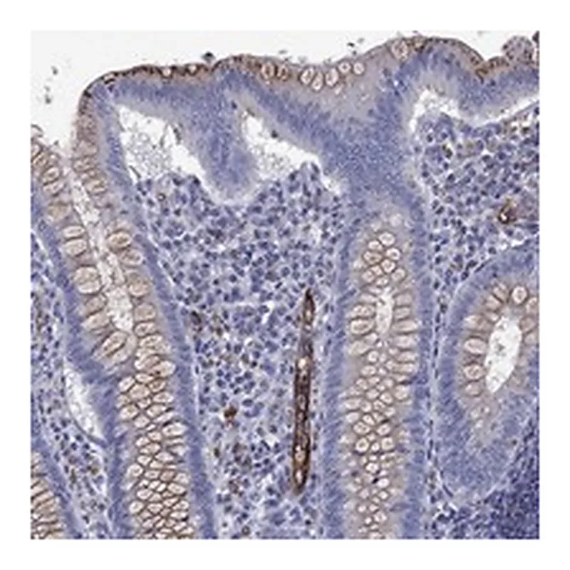 Atlas Antibodies Anti-MADCAM1 Antibody