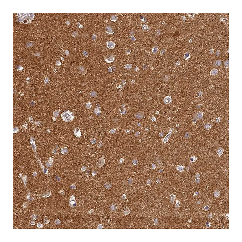 Atlas Antibodies Anti-MADD Antibody