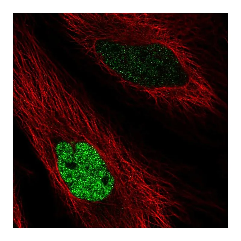 Atlas Antibodies Anti-MAFK Antibody
