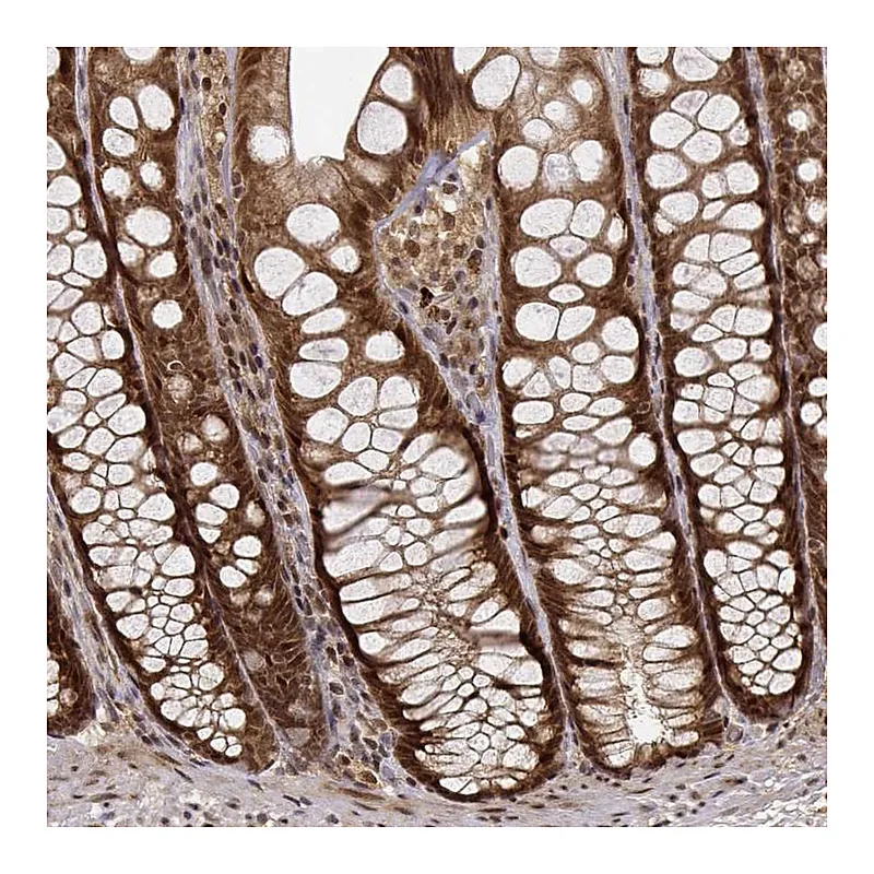Atlas Antibodies Anti-MAEA Antibody