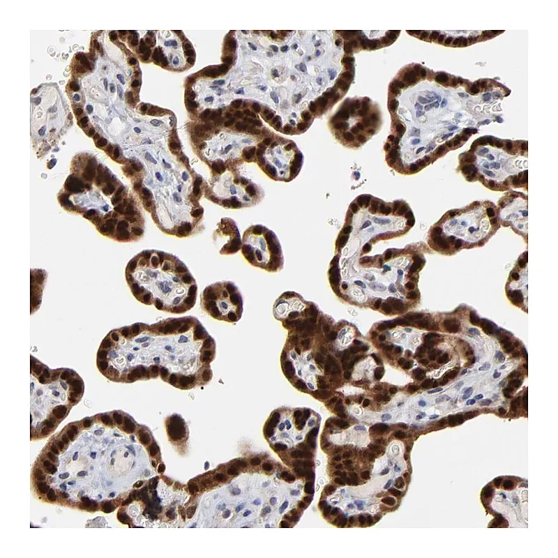 Atlas Antibodies Anti-MAGEA10 Antibody