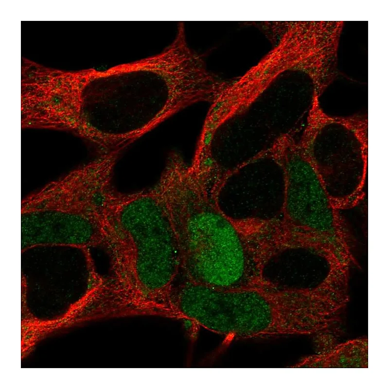 Atlas Antibodies Anti-MAGEA10 Antibody