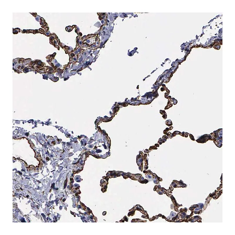 Atlas Antibodies Anti-MAGEB10 Antibody