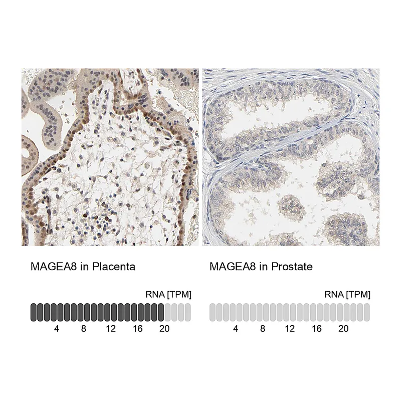 Atlas Antibodies Anti-MAGEA8 Antibody