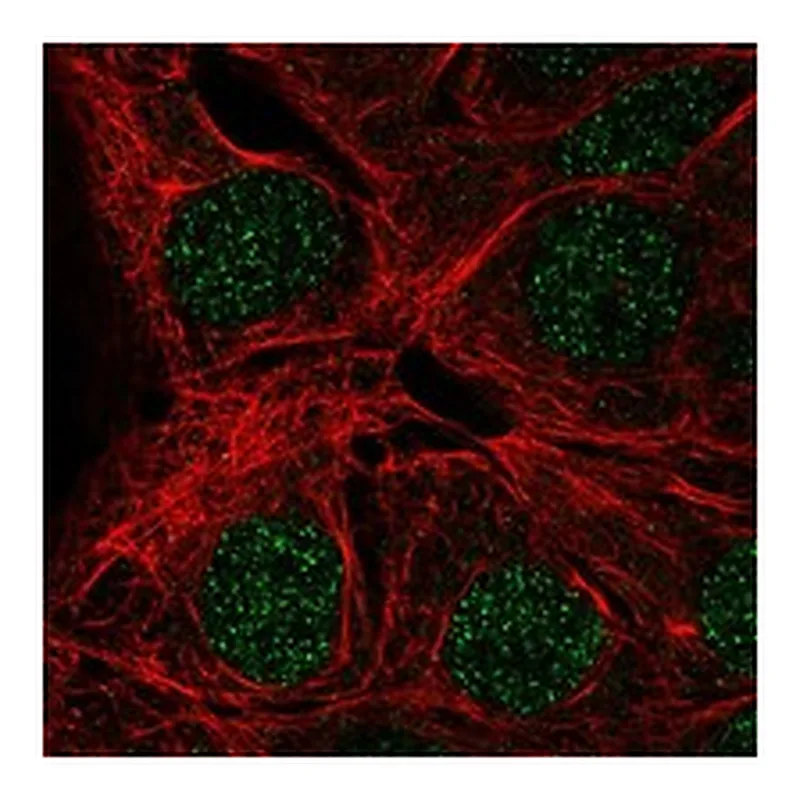 Atlas Antibodies Anti-MAGEA9 Antibody