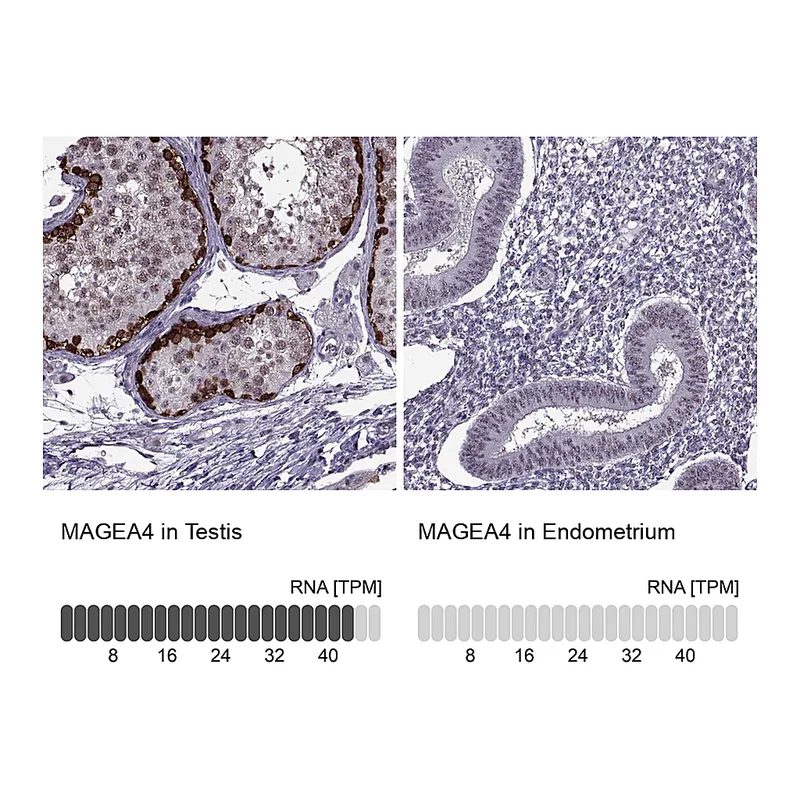 Atlas Antibodies Anti-MAGEA4 Antibody