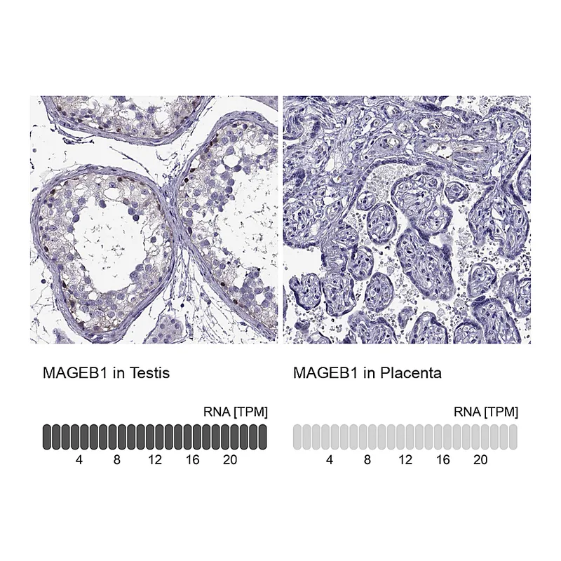 Atlas Antibodies Anti-MAGEB1 Antibody