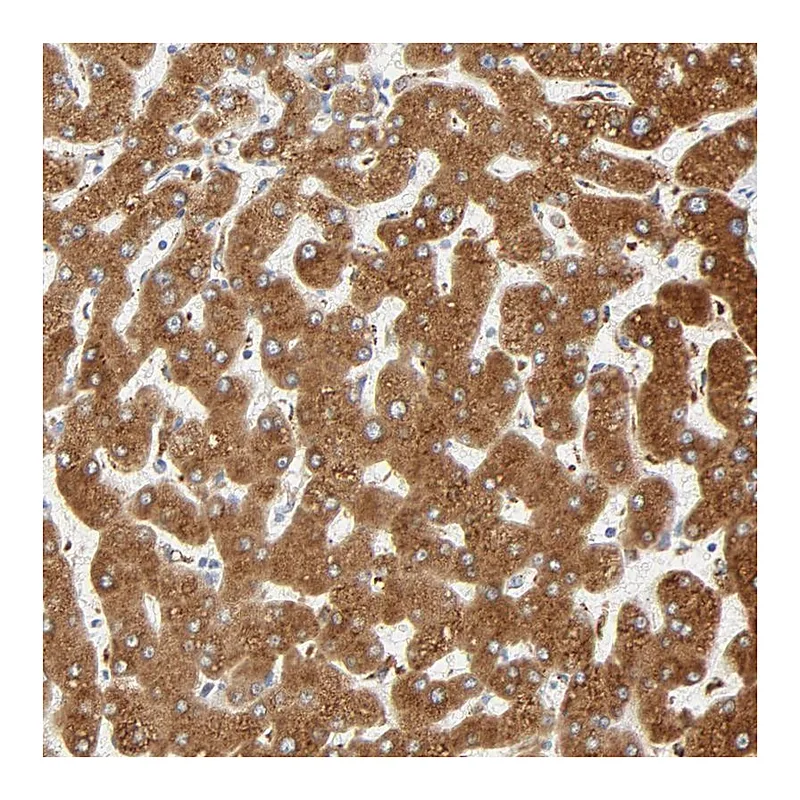 Atlas Antibodies Anti-MAGEB17 Antibody