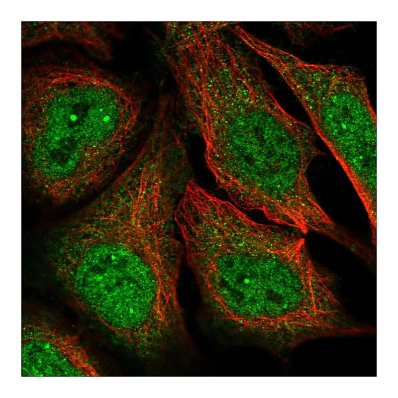 Atlas Antibodies Anti-MAGEA11 Antibody