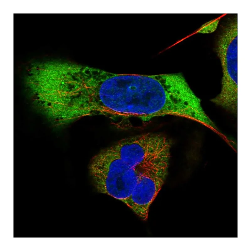 Atlas Antibodies Anti-MAGEB2 Antibody