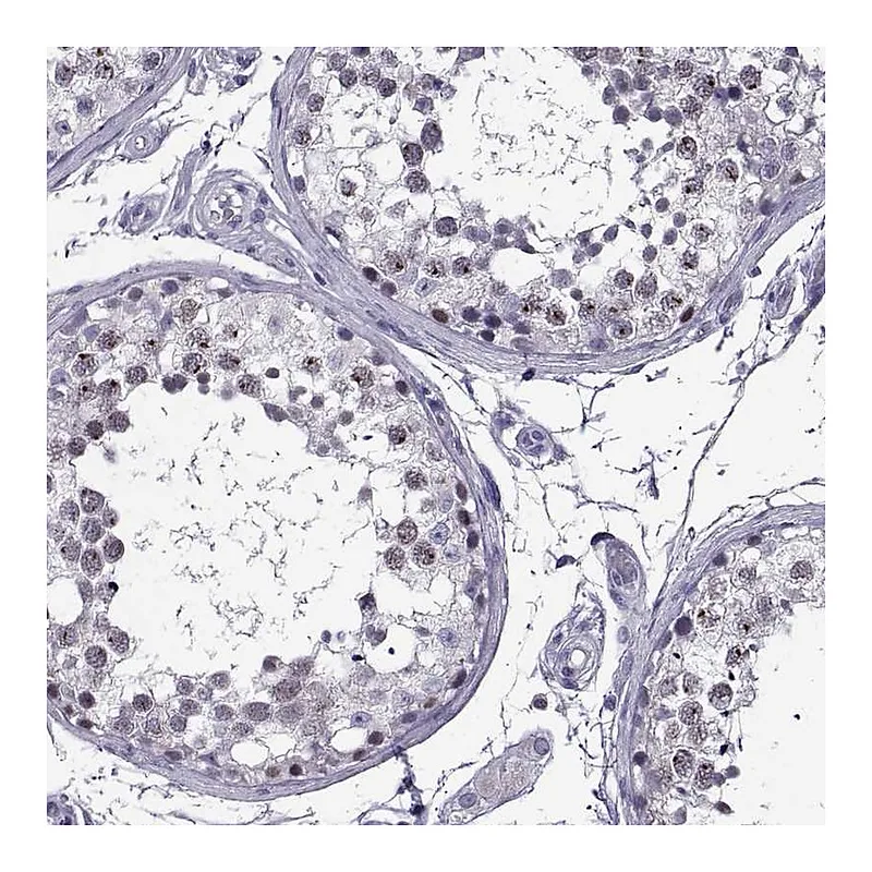 Atlas Antibodies Anti-MAGEB18 Antibody