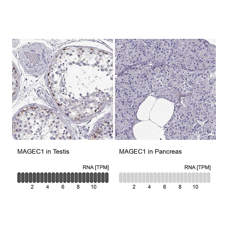 Atlas Antibodies Anti-MAGEC1 Antibody