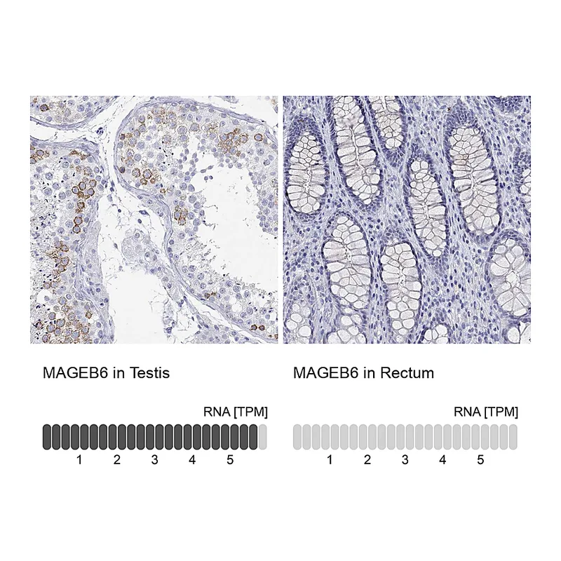 Atlas Antibodies Anti-MAGEB6 Antibody