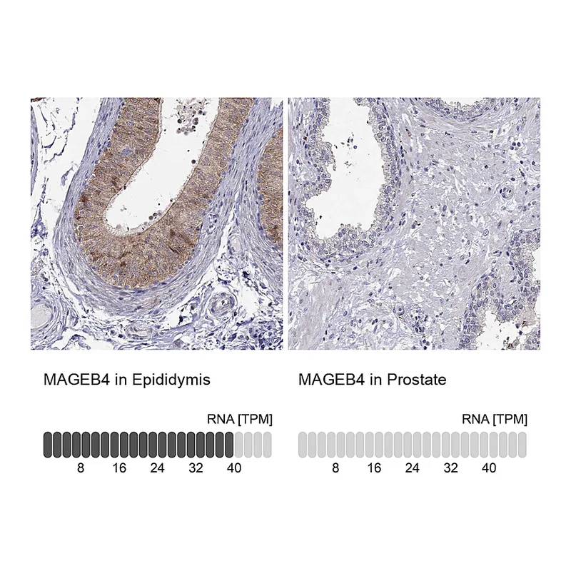 Atlas Antibodies Anti-MAGEB4 Antibody