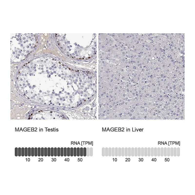 Atlas Antibodies Anti-MAGEB2 Antibody