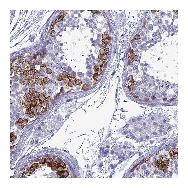 Atlas Antibodies Anti-MAGEB6 Antibody