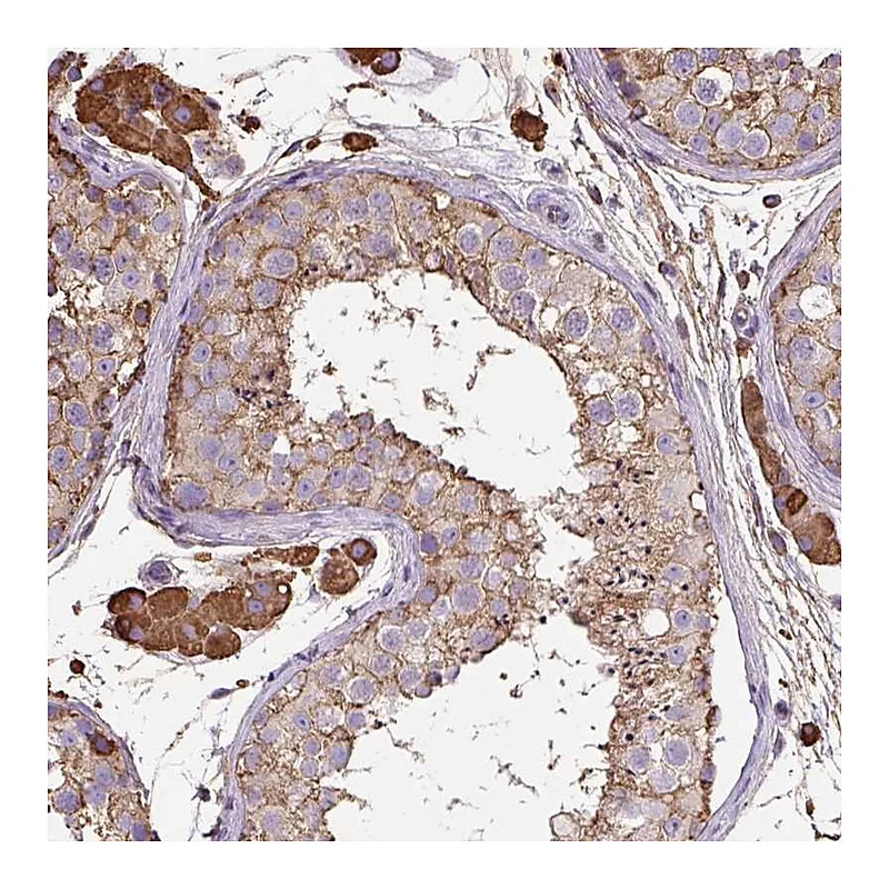 Atlas Antibodies Anti-MAGEB5 Antibody