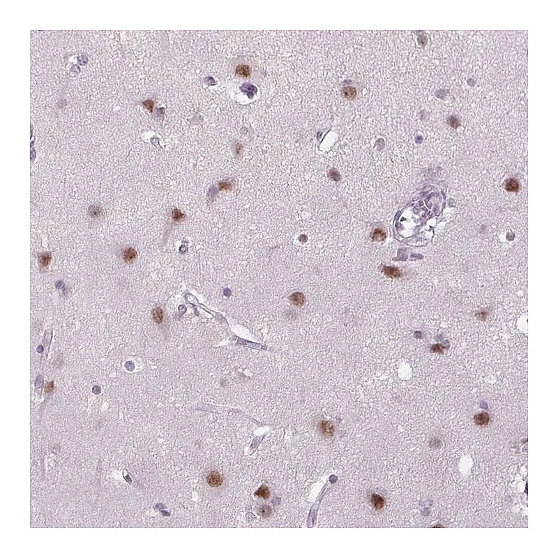 Atlas Antibodies Anti-MAGEB3 Antibody